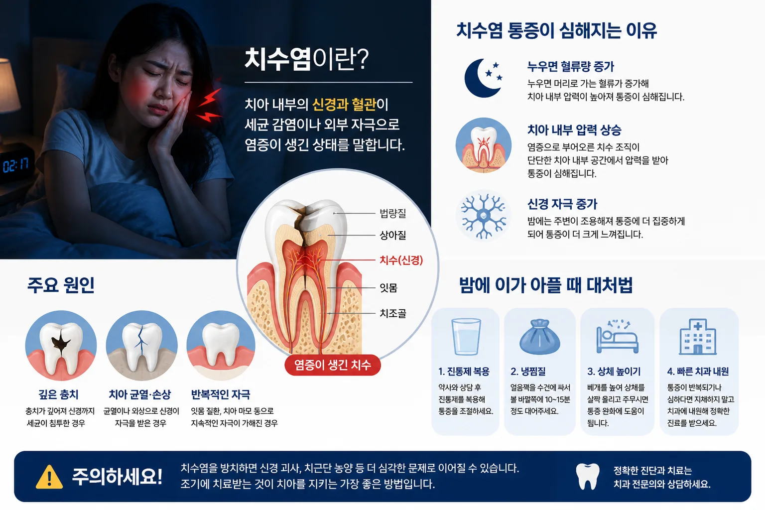 irreversible_pulpitis.webp